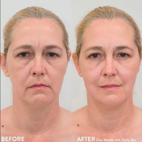 Nurse Jamie Skincare Nurse Jamie Uplift Facial Massaging Beauty